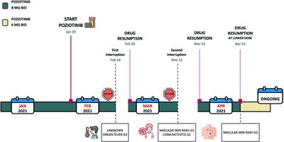 Case Report: Exceptional Response to Poziotinib in Patient with Metastatic Non-Small Cell Lung Cancer With EGFR Exon 20 Insertion Mutation